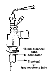 Jet Ventilator Adapter Single-Patient Use